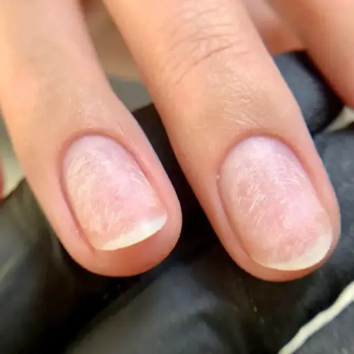 Dépose Ongles Gel - 15€ 