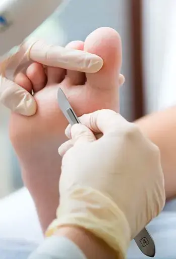 Pédicure Médicale + Semi-permanent Pieds - 55€